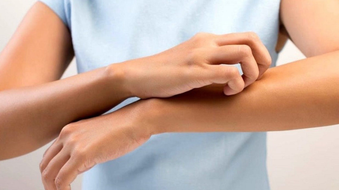 Come affrontare le allergie estive e ridurre i sintomi fastidiosi