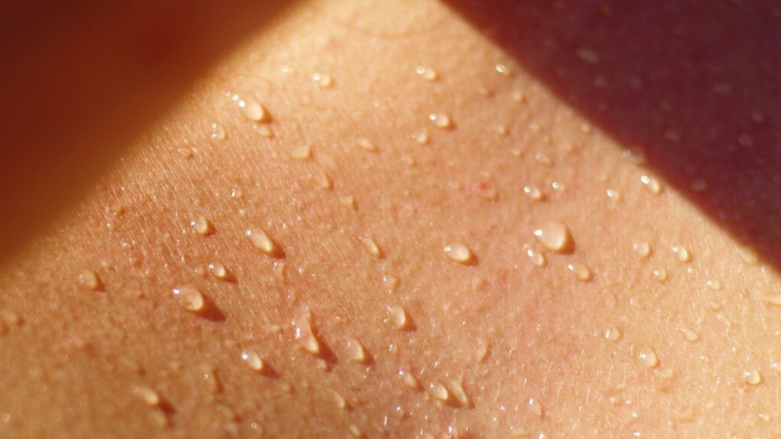 Come contrastare l’eccessiva sudorazione estiva