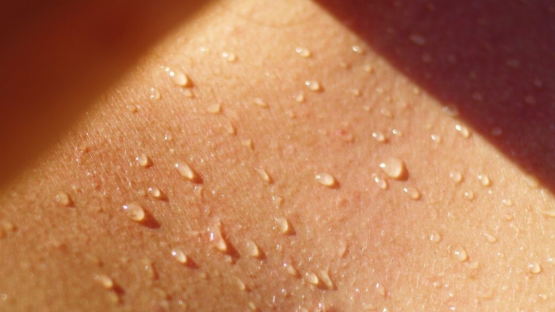 Come contrastare l’eccessiva sudorazione estiva