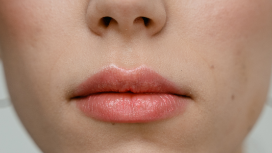 Cura le tue labbra in inverno